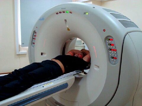 bel og'rig'i uchun MRI diagnostikasi