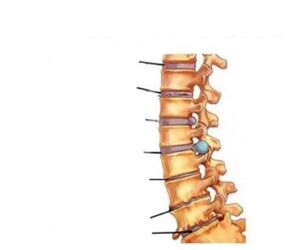 Osteokondroz alomatlari
