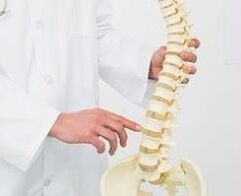 lomber osteokondrozroz