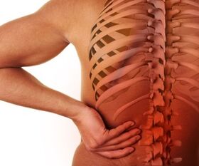 lomber osteoxondroz bilan bel og'rig'i